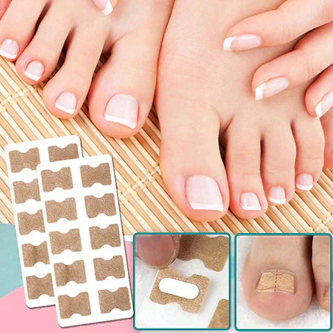 Nagelreparatur-Pflaster - Sofortige Schmerzlinderung & Gesundes Nagelwachstum