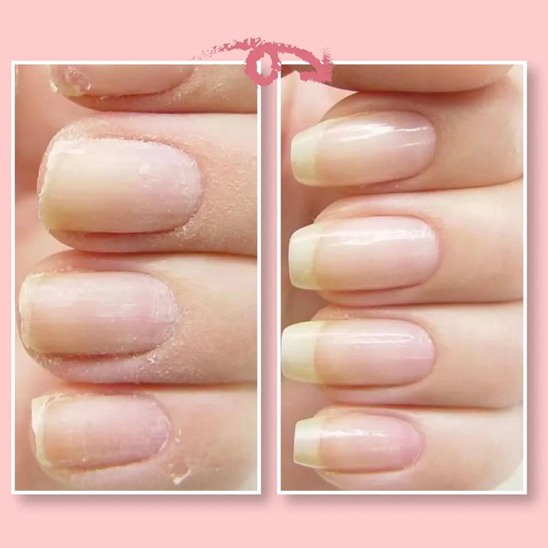 Schutzgel zur Nagelreparatur | 1+1 GRATIS