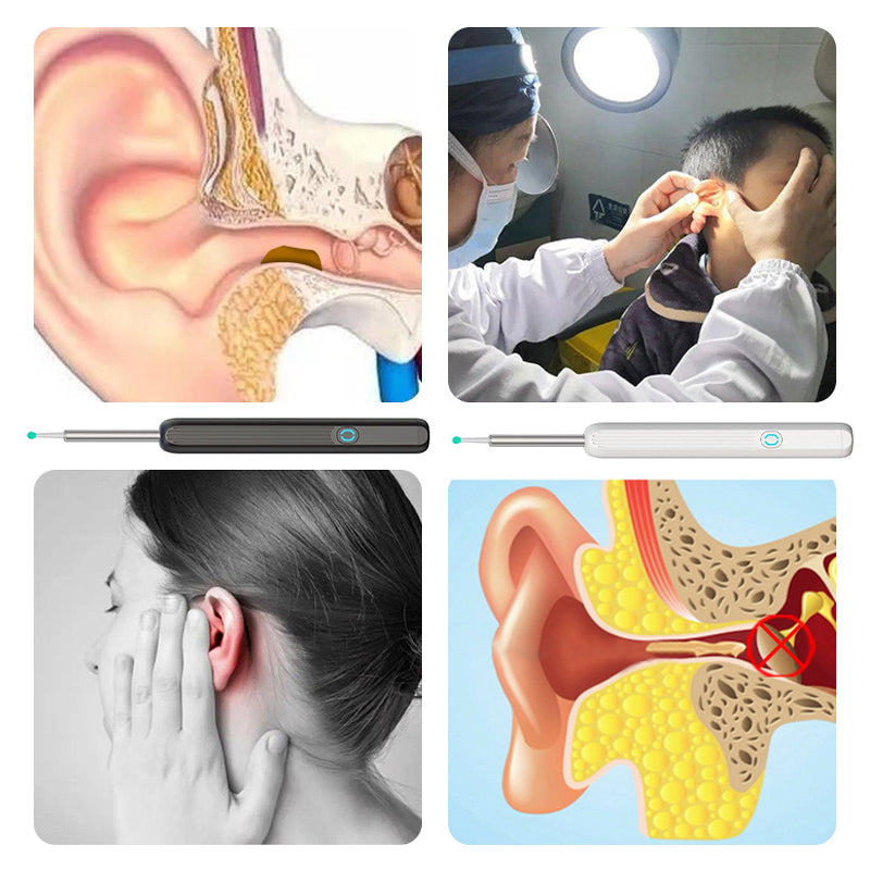 Intelligenter sichtbarer Earpick
