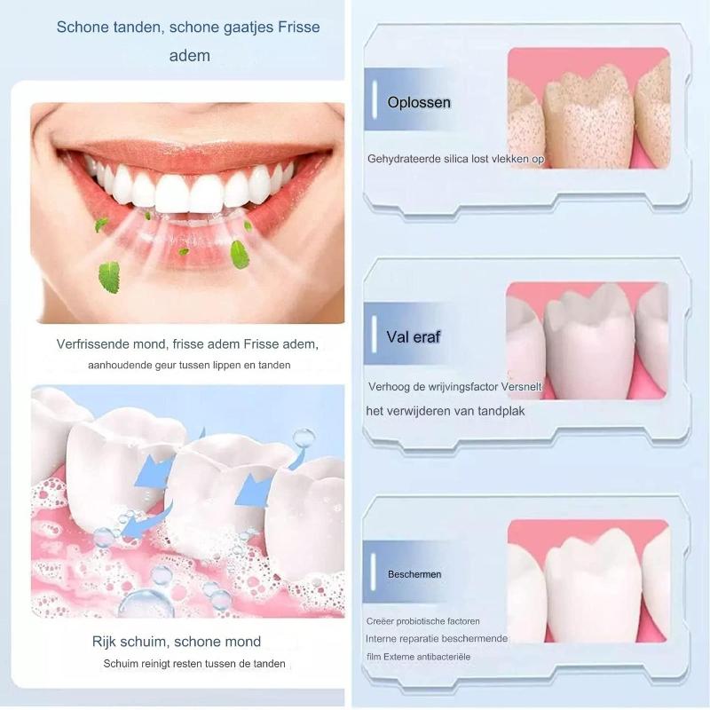 PureSmile - 100ML SP-6 Probiotische Whitening-Zahnpasta | 1+1 GRATIS