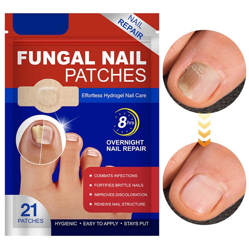 Pilz Nagelpflaster für Zehennagelpilz Linderung | 60+60 GRATIS