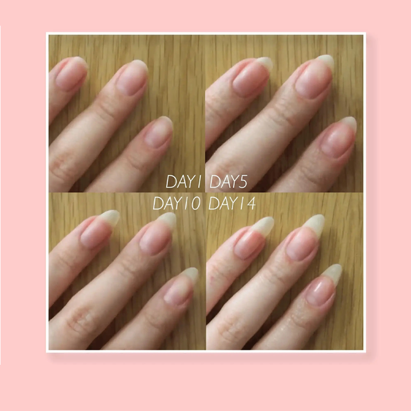 Schutzgel zur Nagelreparatur | 1+1 GRATIS