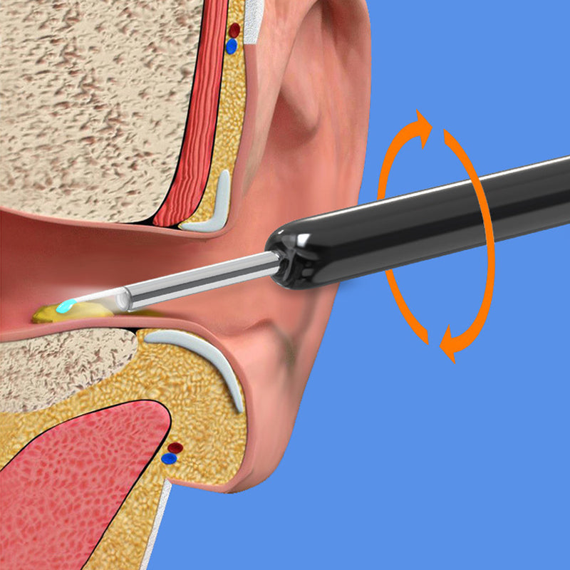 Intelligenter sichtbarer Earpick