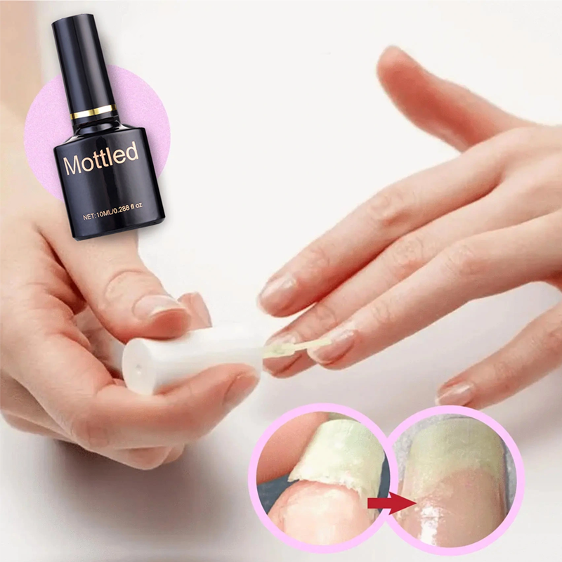 NailRescue - Schutzgel für die Nagelreparatur | 50% RABATT