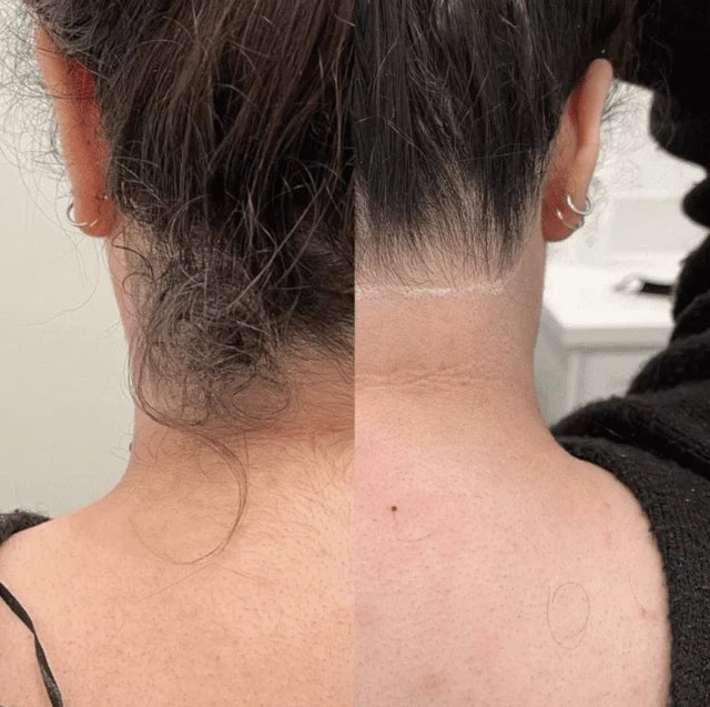 SmoothGlow  30 ML - Effektiver Haarentfernungsschaum | 1+1 GRATIS