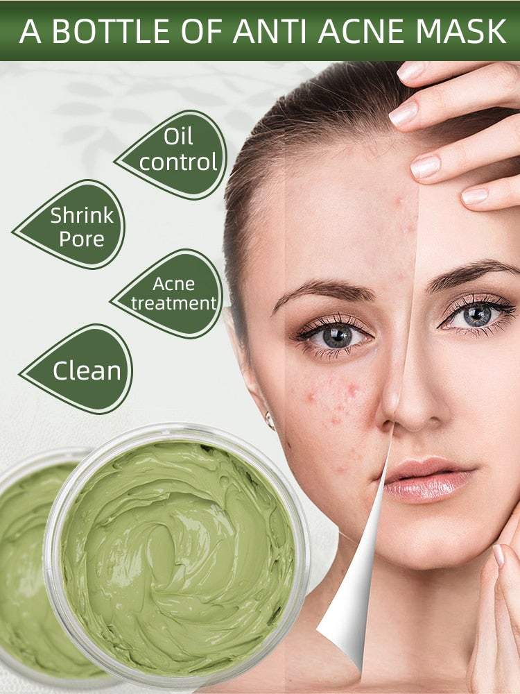 50% RABATT | Teebaum Akne Behandlung Lehm Maske