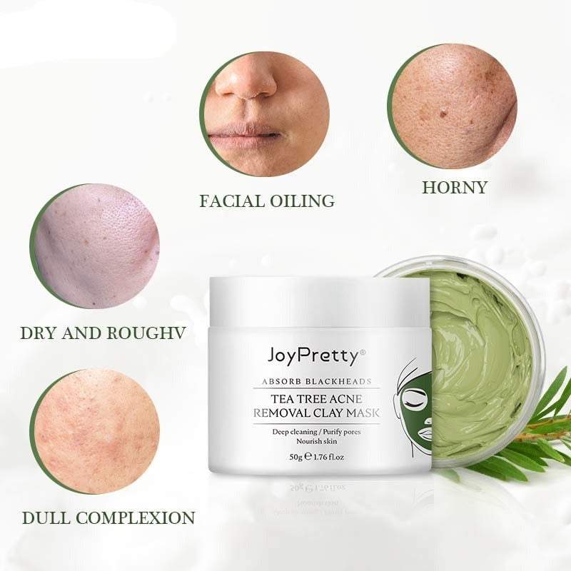 50% RABATT | Teebaum Akne Behandlung Lehm Maske
