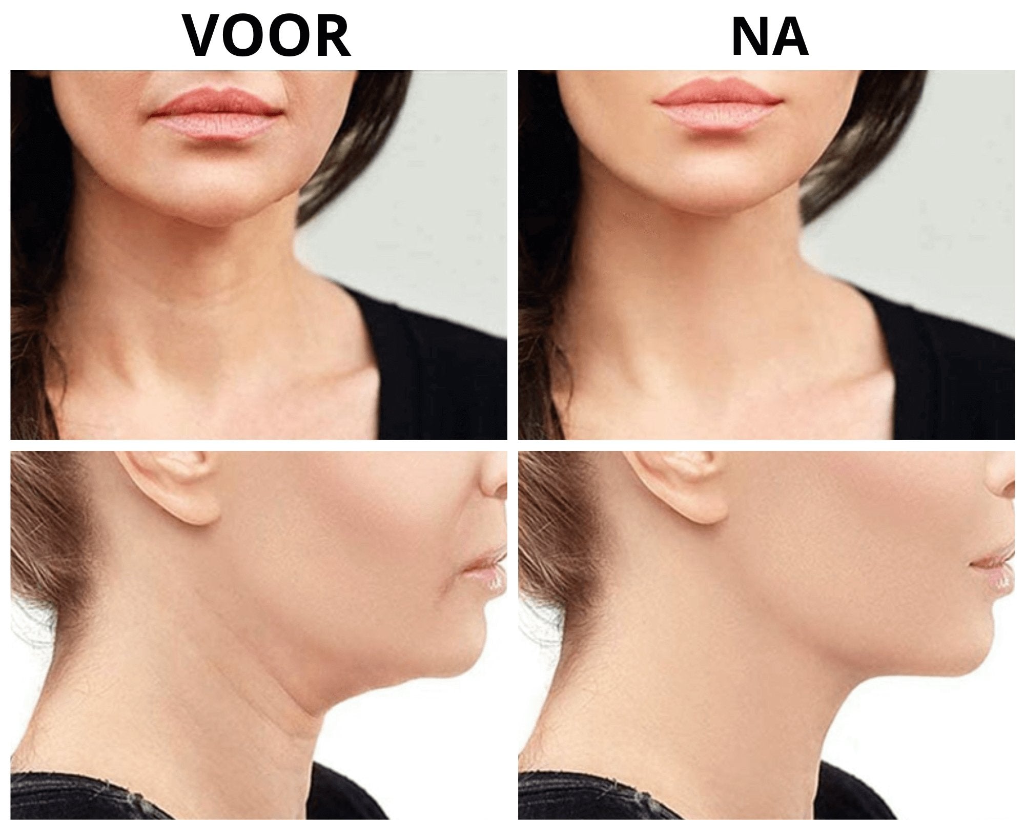 Glow™ | Verbessern Sie Ihre Haut!
