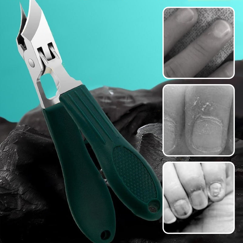 ClipClean™ – Hygienisches Schneiden Ohne Nagelchaos | 1+1 GRATIS