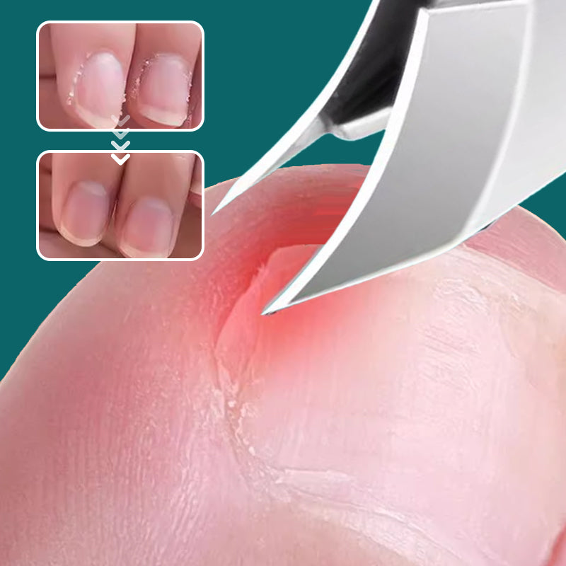 ClipClean™ – Hygienisches Schneiden Ohne Nagelchaos | 1+1 GRATIS