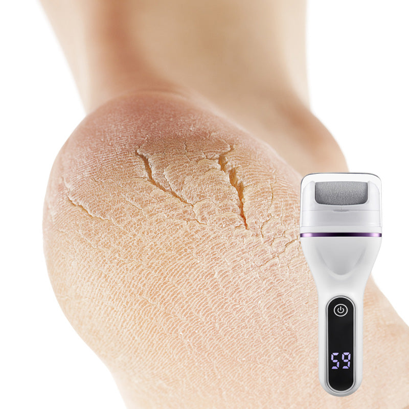 SoftStep™ – Glatte Füße in Minuten | 50% RABATT