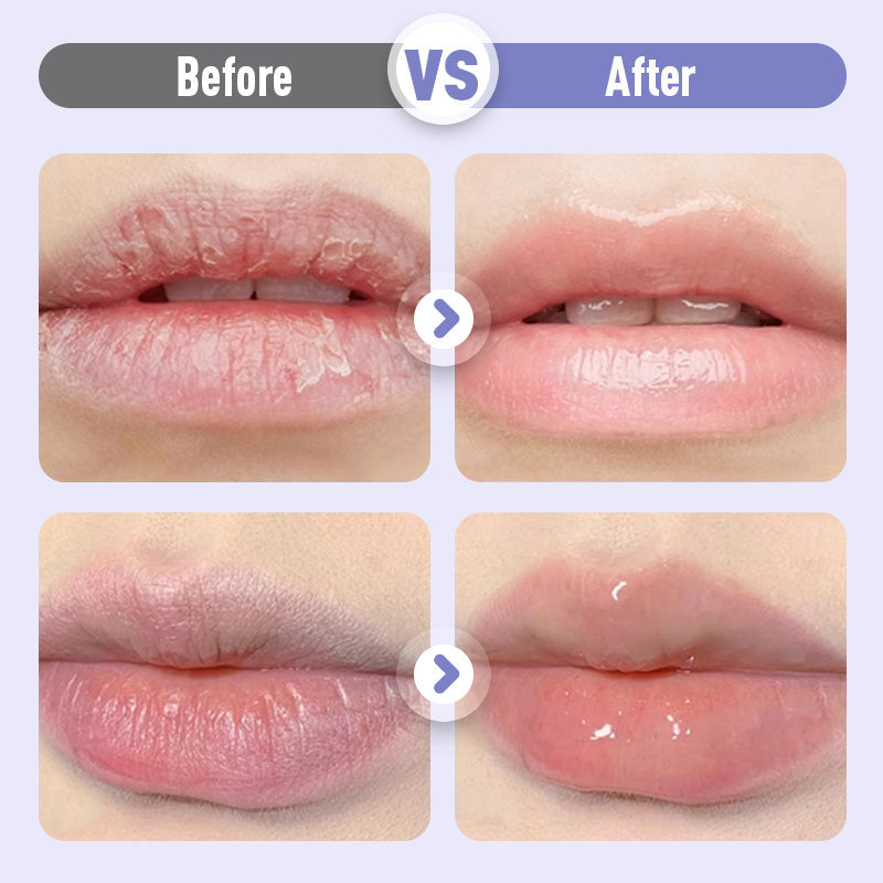 LumiLips™ – Jugendlich Glatte Lippen | 1+2 GRATIS